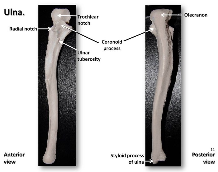 Radius and ulna anterior view