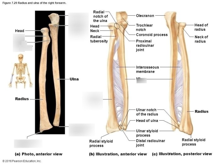 Radius and ulna anterior view