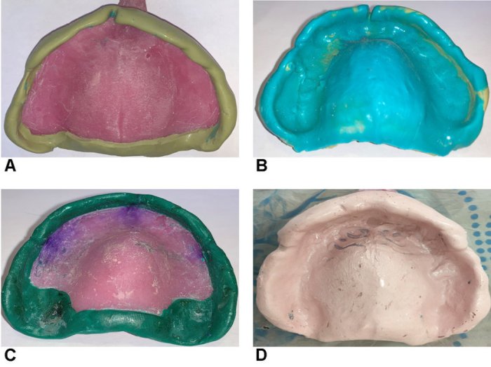 Final impression material for complete denture