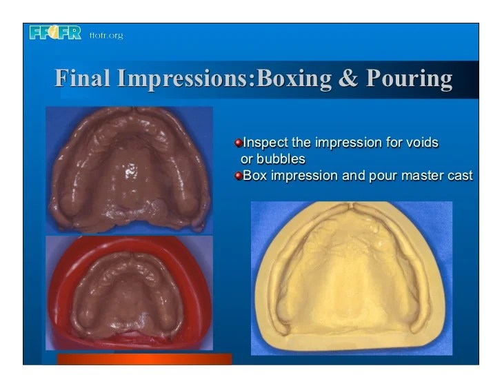 Impression final complete denture border technique dental dentures molding figure